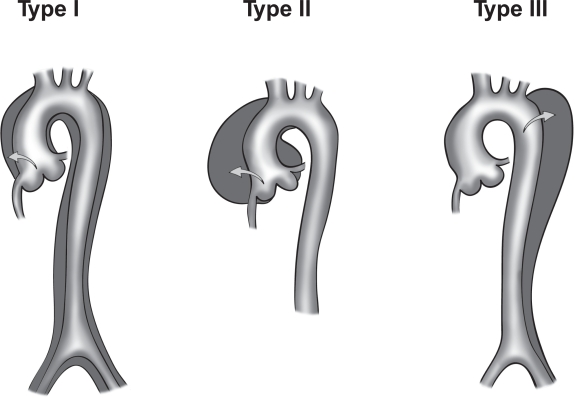 Figure 3A