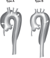 Figure 3B