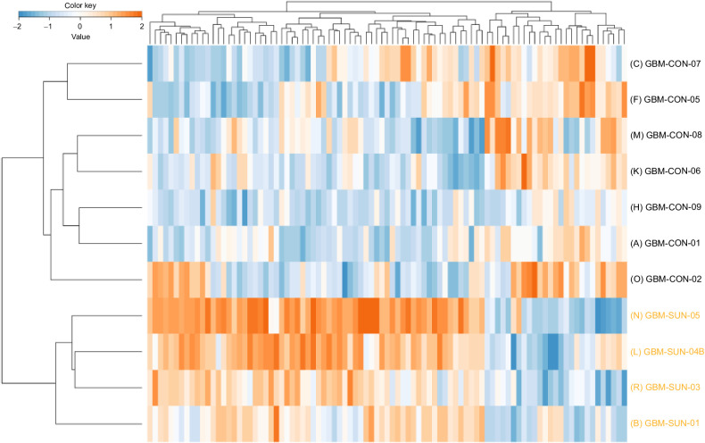 Figure 2. Supervised clustering analysis of the tyrosine phosphoproteome. Supervised hierarchical clustering of differential phosphopeptides (P < 0.05) identified by tyrosine-phosphoproteomics shows separation of sunitinib-treated and control tumor tissues from 11 patients with glioblastoma. The heatmap shows the relative phosphopeptide intensities (z-score) in these samples based on log10-transformed values (orange, high abundance; blue, low abundance). SUN, sunitinib-treated; CON, control.