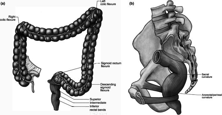 “Flexures and bends of the large intestine: Current terminology and a ...