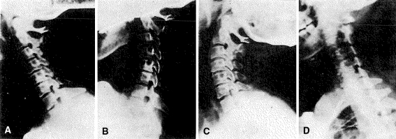 Fig. 3A–D