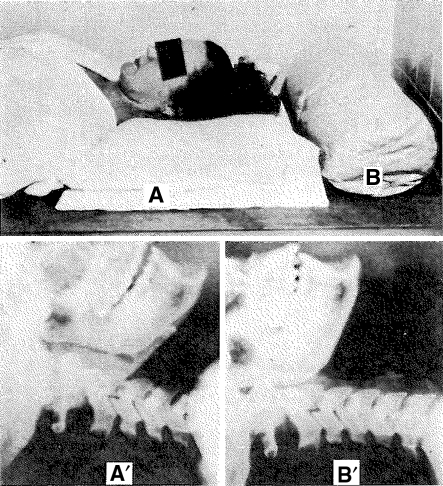 Fig. 6A–B