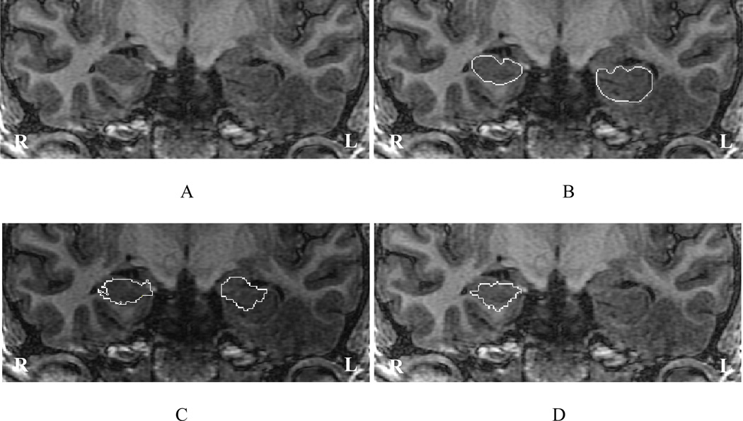 Fig. 10