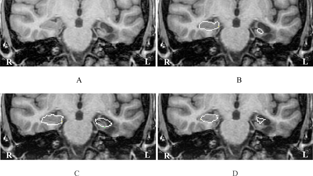 Fig. 11