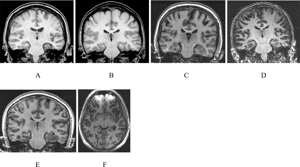 Fig. 6