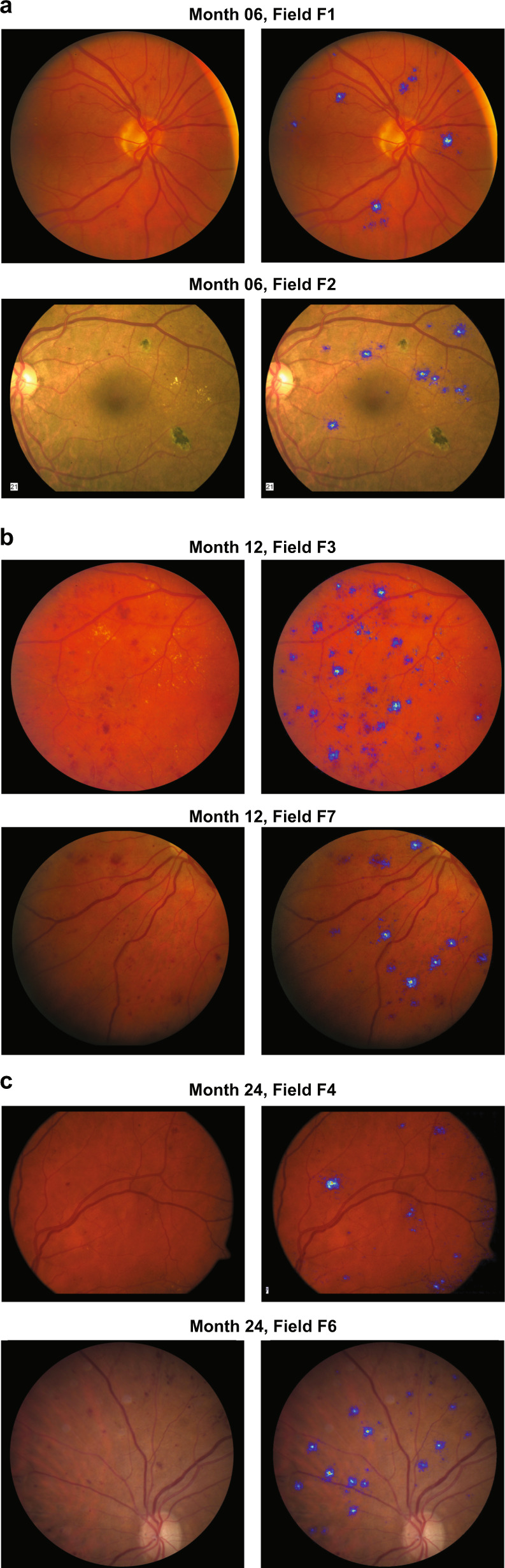 Fig. 4