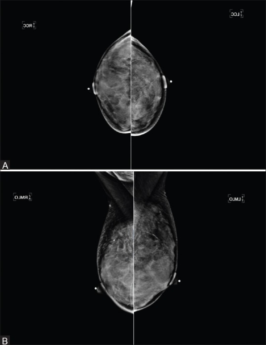 Figure 2 (A and B)