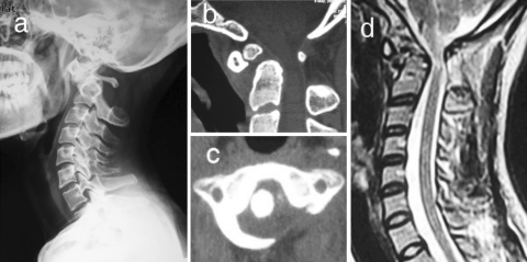 Fig. 1