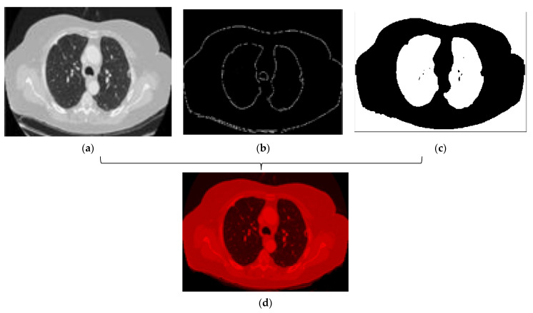 Figure 11