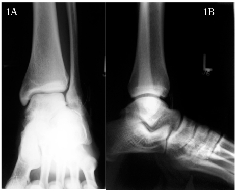 Figure 1A, B