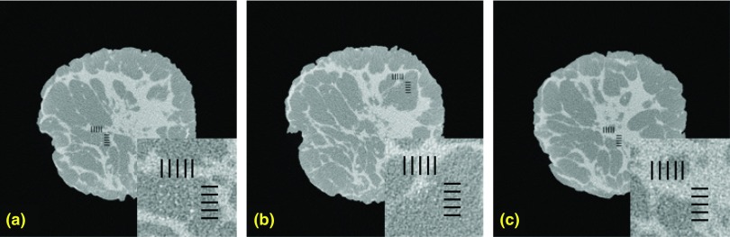 Figure 22