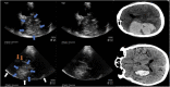 FIGURE 14