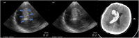 FIGURE 15