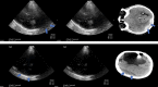 FIGURE 16