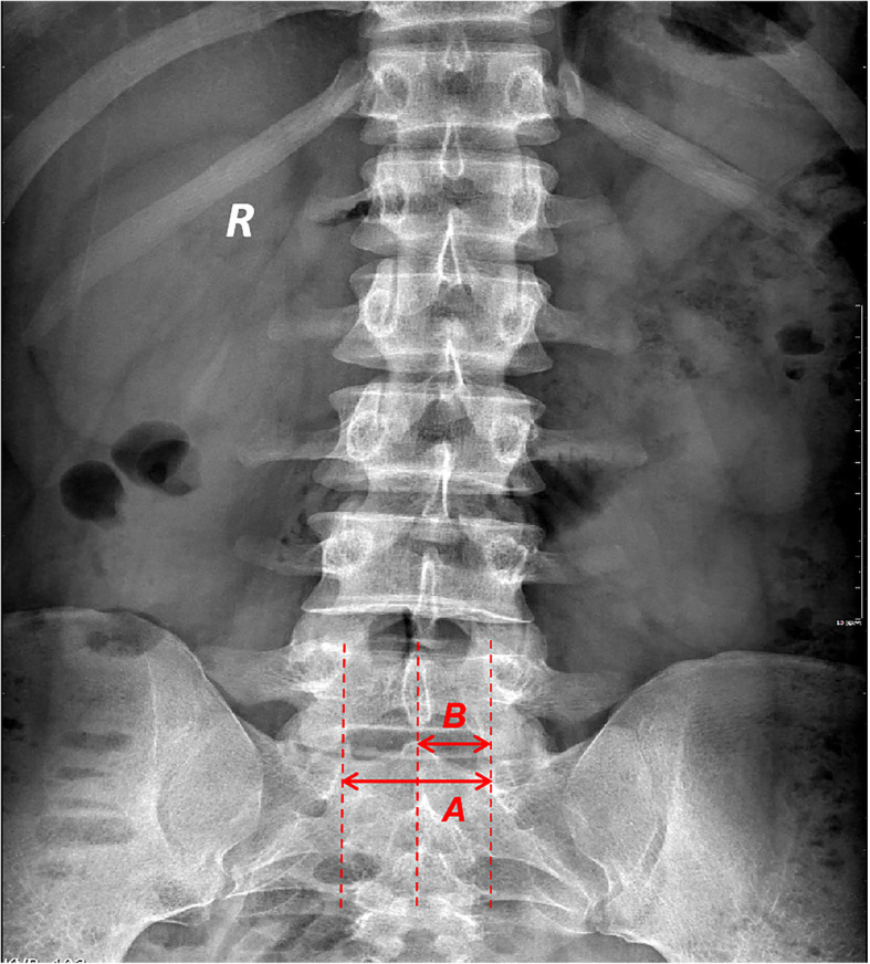 Fig. 1