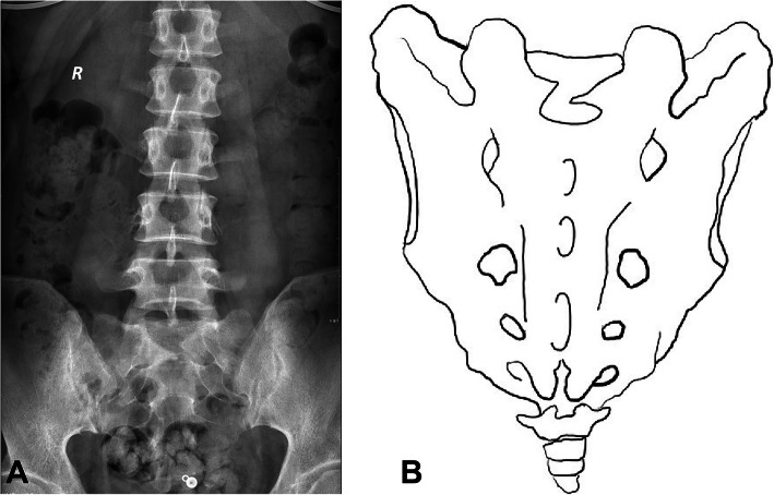 Fig. 4