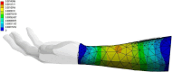 Fig 13