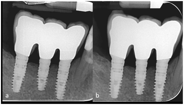 Figure 14