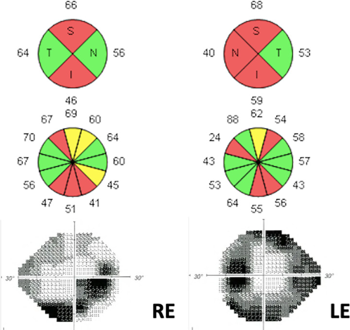 Fig 4