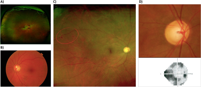 Fig 3