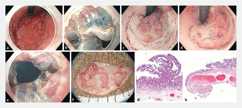 Fig. 1