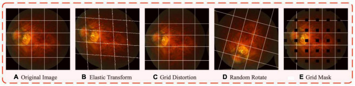 FIGURE 4