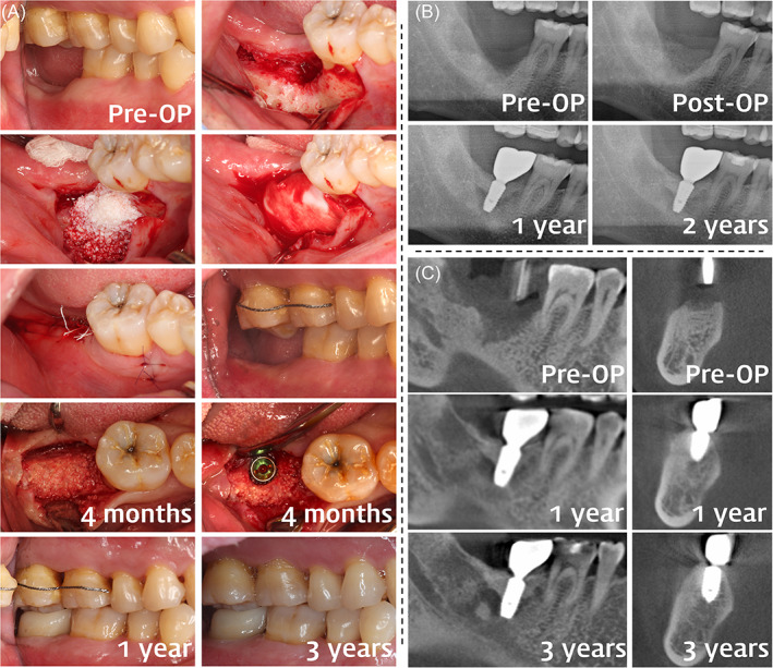 FIGURE 2