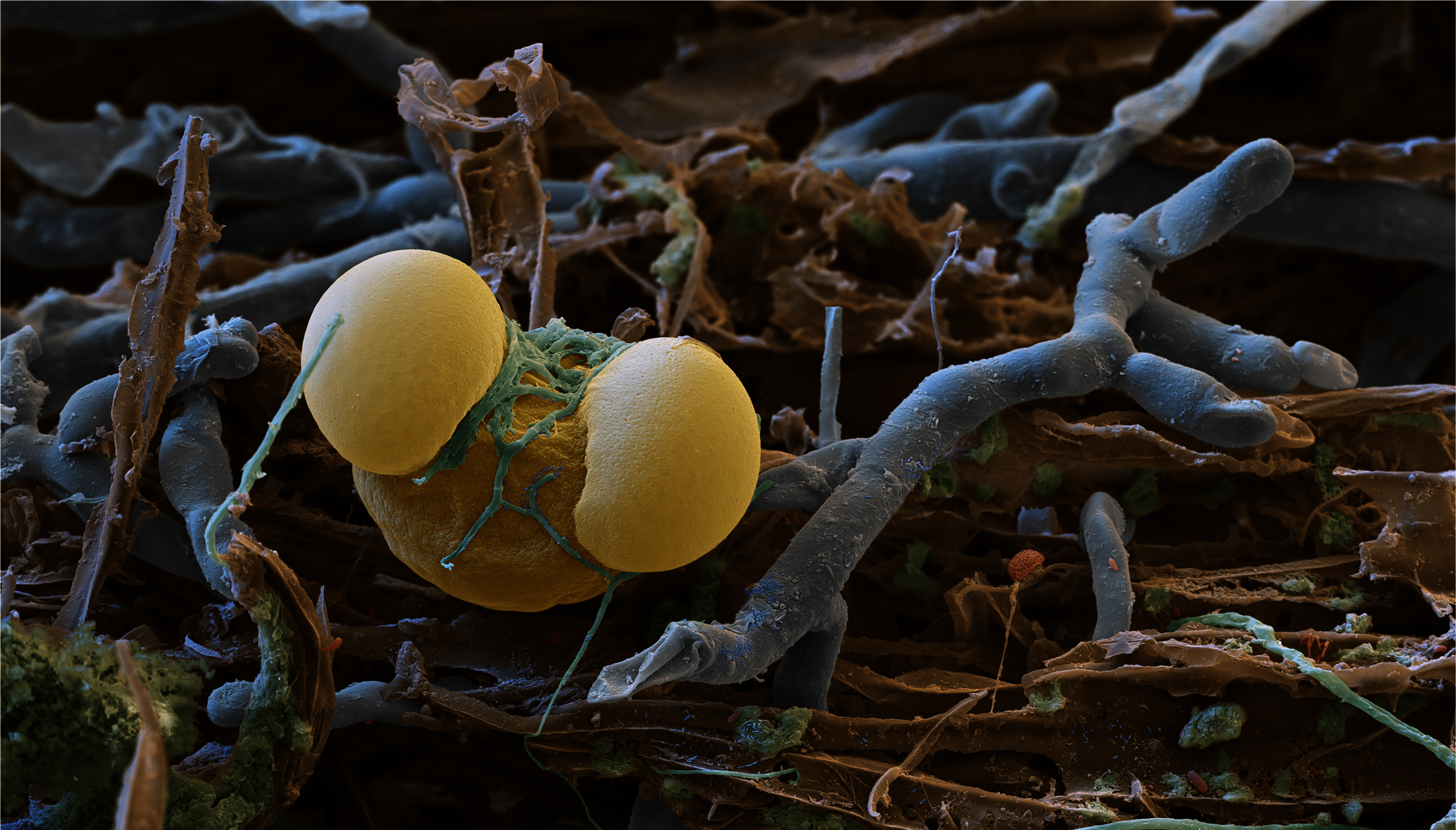 Small green filaments drape a rounded yellow object resting on brown fibers, with elongated, branching threads around it.