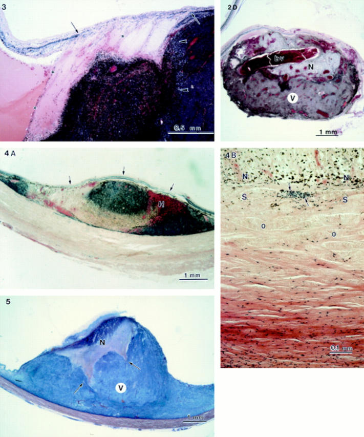 Figure 3  