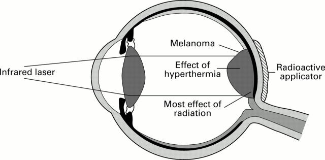 Figure 6  