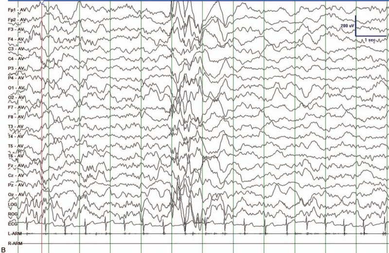 Figure 1 (Continued)