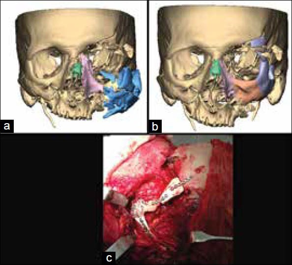 Figure 13