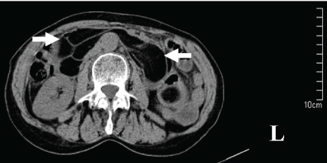 [Table/Fig-1]: