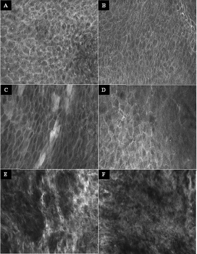 Figure 3