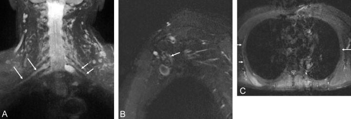 Fig. 18.