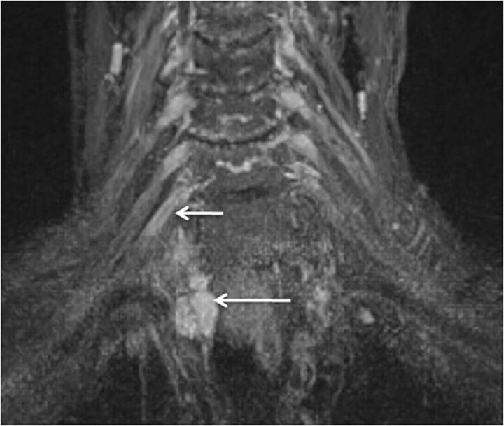 Fig. 17.