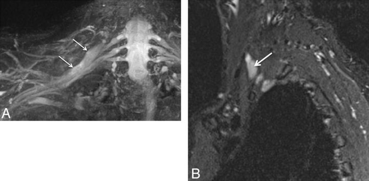 Fig. 15.