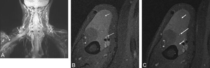 Fig. 21.