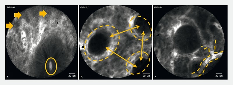 Fig. 1