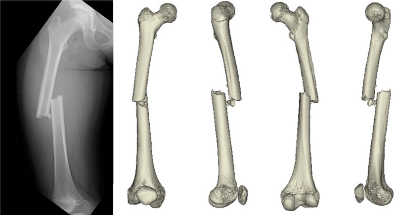Fig. 1