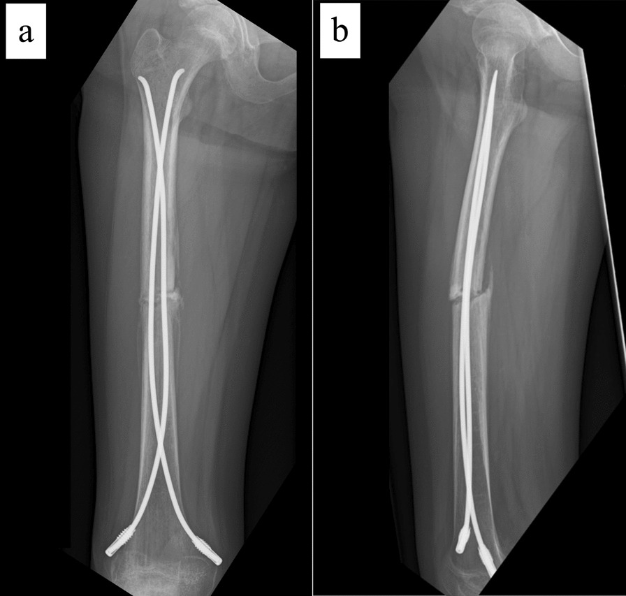 Fig. 4
