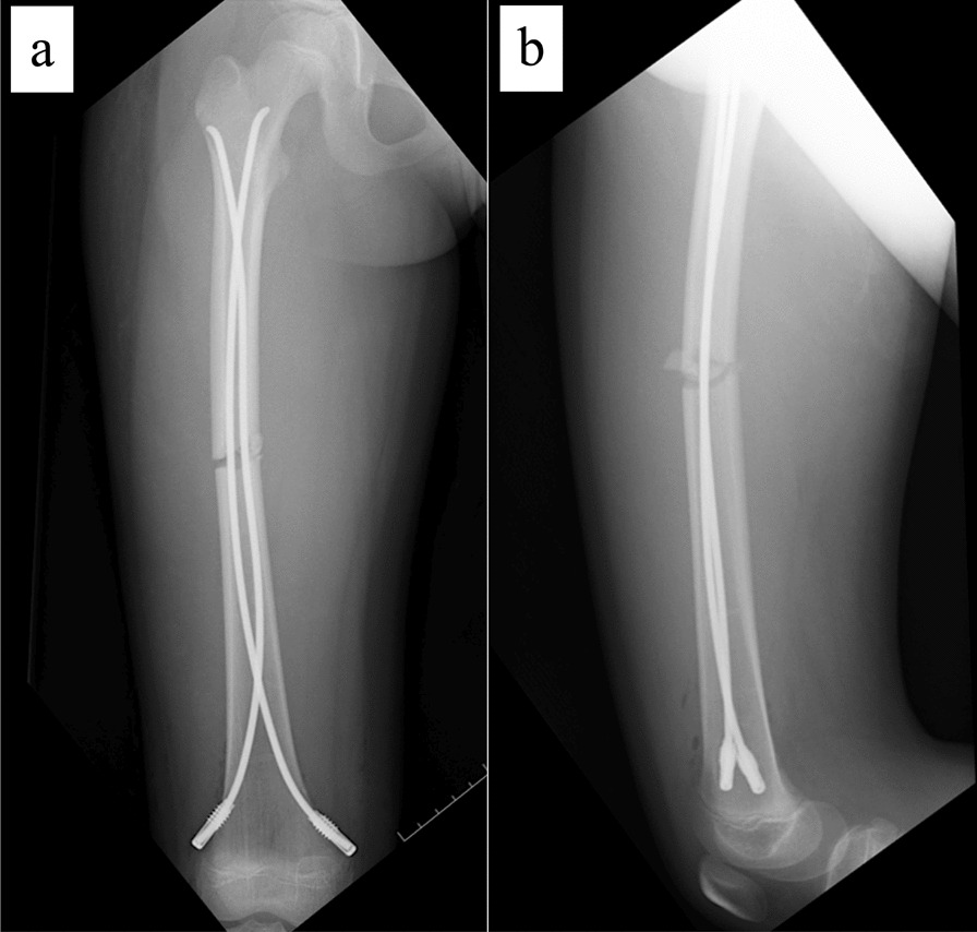 Fig. 2