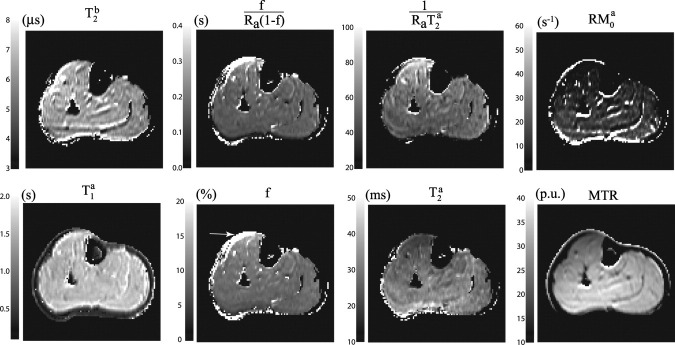 FIG. 4