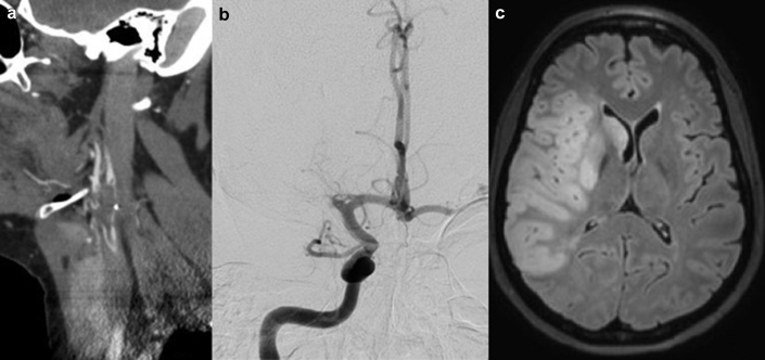 Figure 1