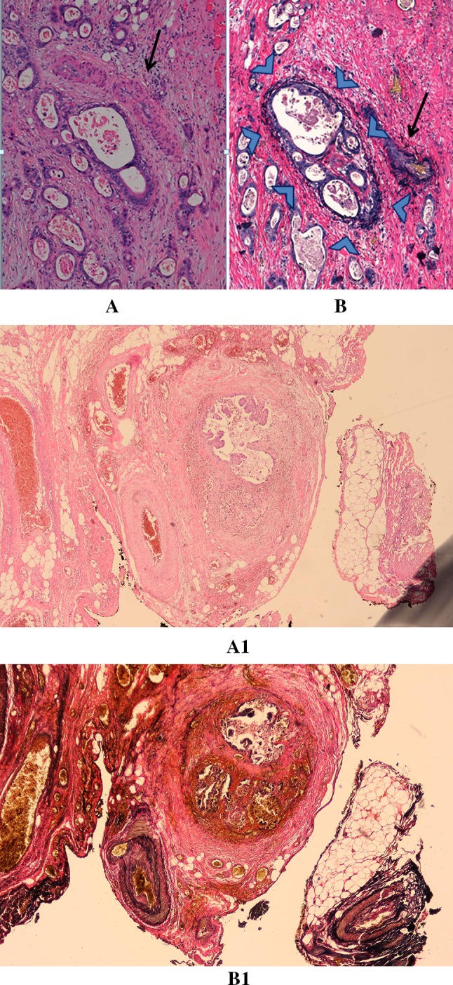 Fig. 1