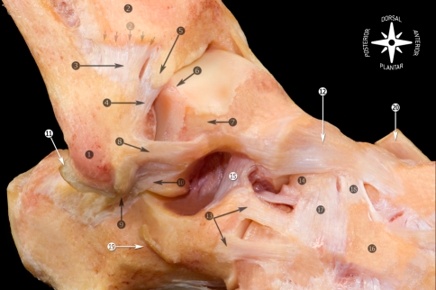 Fig. 19