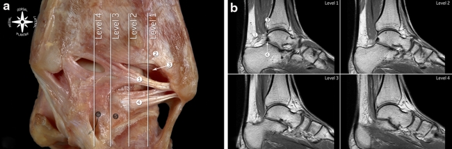 Fig. 9