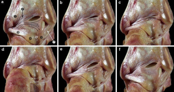 Fig. 11