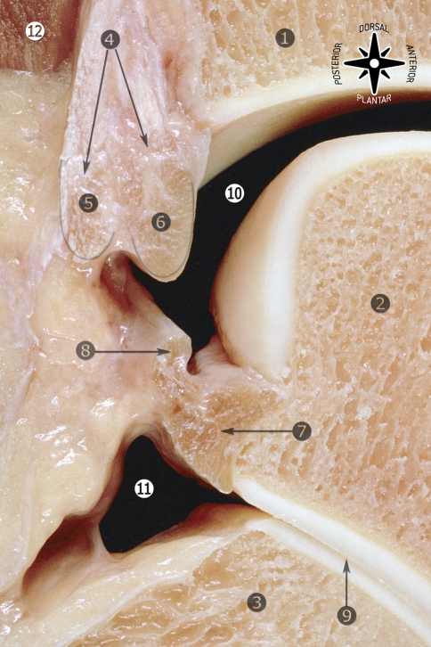 Fig. 21