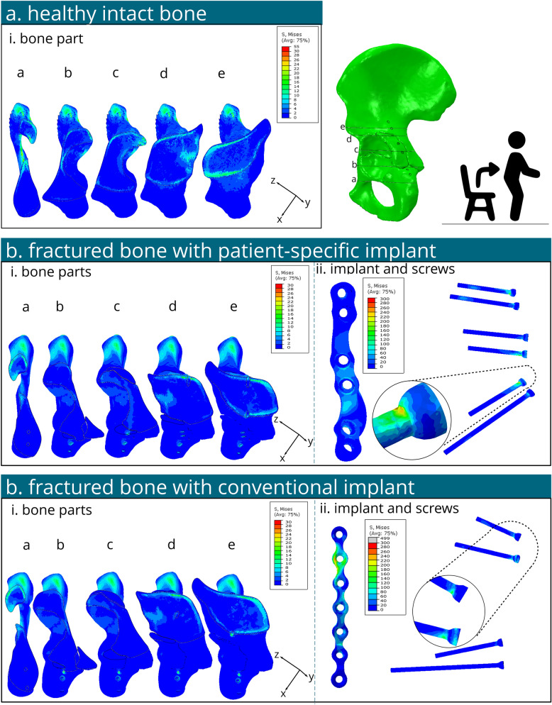 Fig. 4